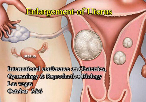 Enlargement of the uterus Photo